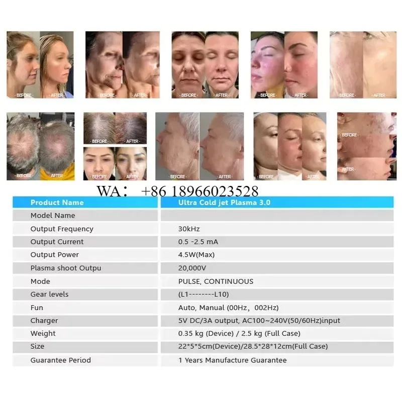 WMWMNU Mini Wireless Plasma Facial Low Temperature Cold Plasma Anti Inflammatory Repair Salon Home Beauty