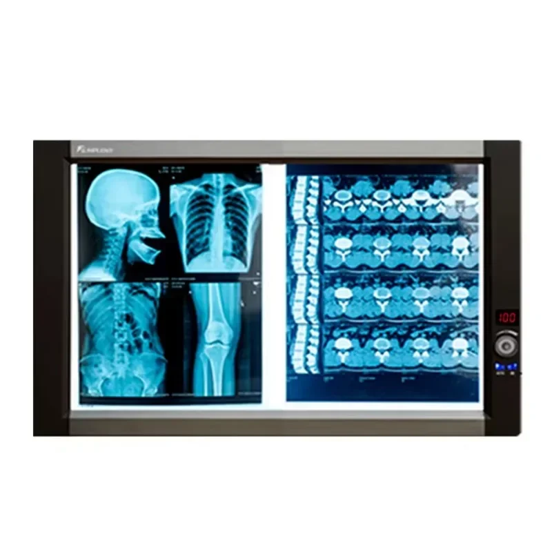 Ultra slim LED 2 bank LED de ntal negatoscope medical X ray film viewer with CE with ISO13485 with three years warranty