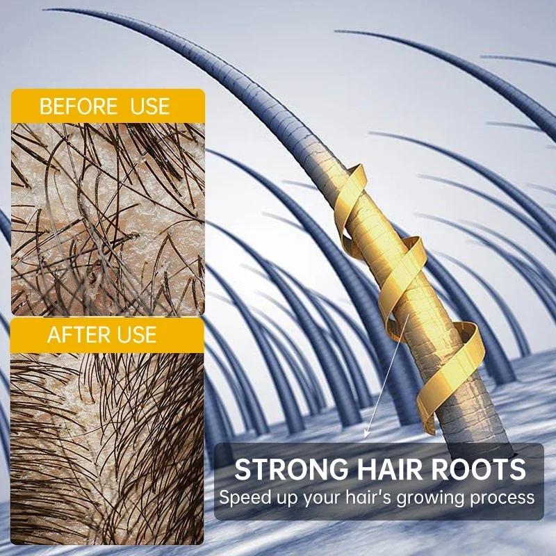 Hair Growth Essential Loss Regrowth Treatment Strengthens Hair Nourishes Scalp Light Weight Non Greasy Improve Scalp Circulation