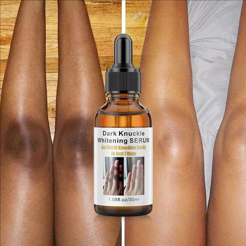 Dark Knuckles Fast Whitening Serum Pigmentation Correctors for Black Skin Hand Knuckle Elbows Knee Intense Stains Remover Serum