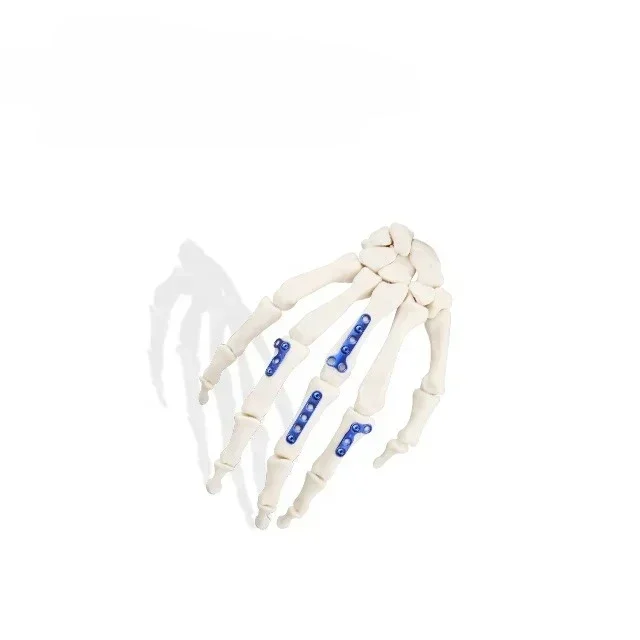 Hand and Foot Instrument Set Names of Orthopedic Metacarpal & Phalangeal Instruments