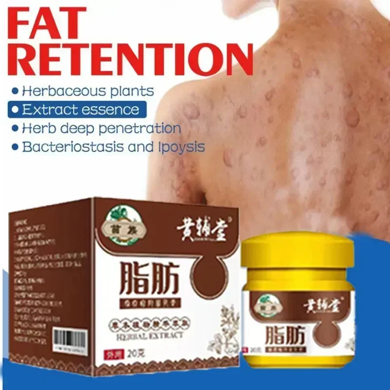 ²⁰²⁵ Lipoma Removal Cream The Whole Body Multiple Subcutaneous Conditioning Cream Eliminate Paste Fiber Paste Skin Care