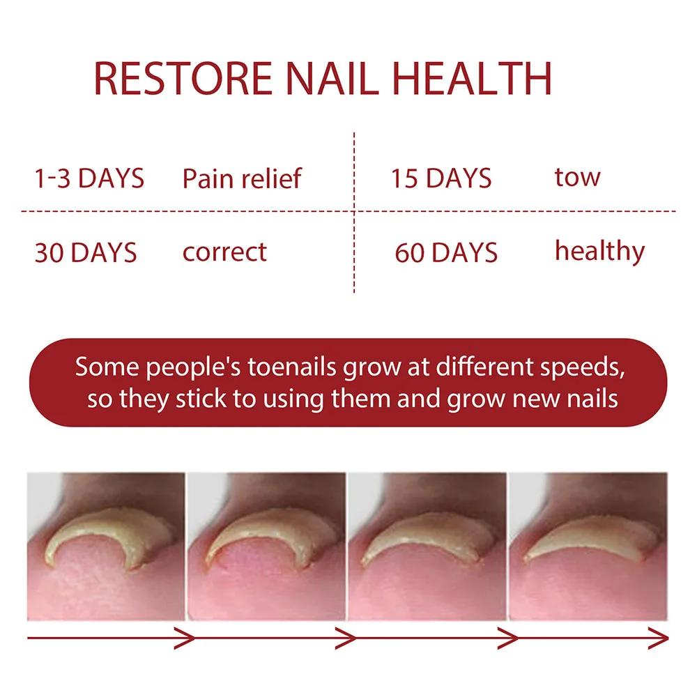 Thickening Nail  Care Oil Gentle Nail Cuticle Oil Strengthener Nail Care Product