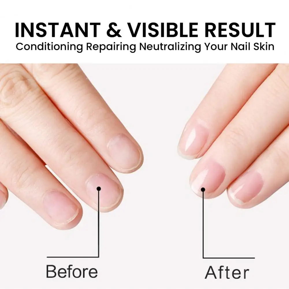 Thin Nail Strengthening Oil Moisturizing Cuticle Oil for Healthier Nails Natural Ingredients Fast Results Nail Strengthening Oil