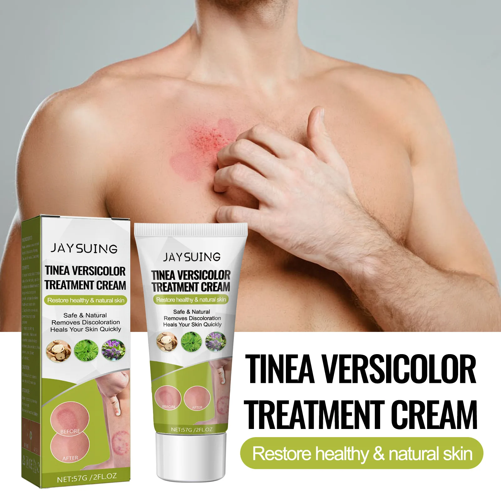 Blemish Repair Cream for Whitening Blemish Blemish Moss Skin Repair Topical Sweat Spot Cream