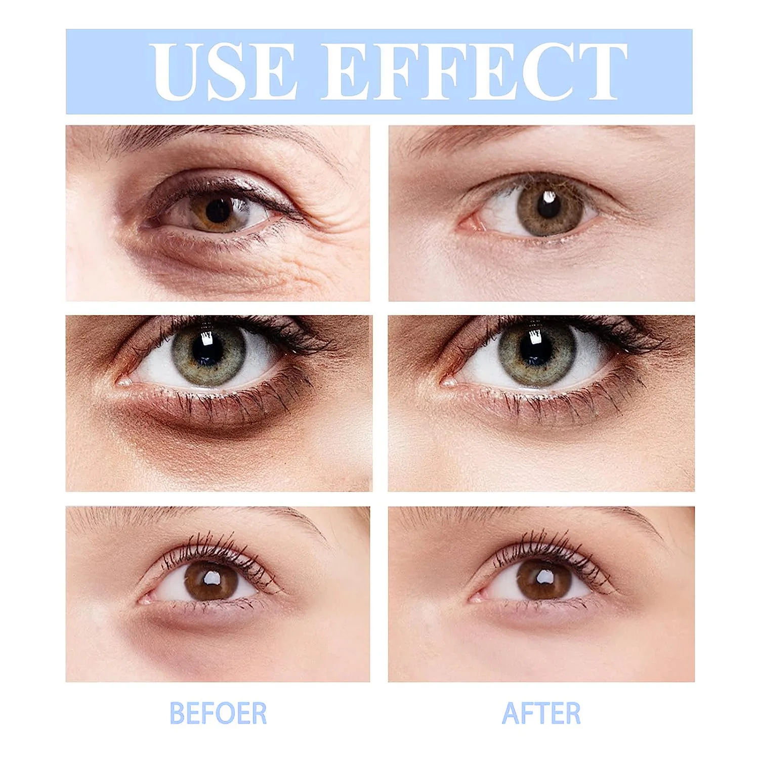 Crema de ojos con Retinol, suero para contorno de ojos, ojeras, antiedad, antiarrugas, Lifting de ojos, blanqueamiento, hidratante, Cosméticos