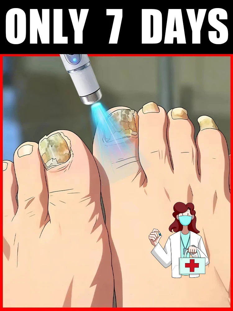 

Лазерное лечение ногтей и удаления онихомикоза