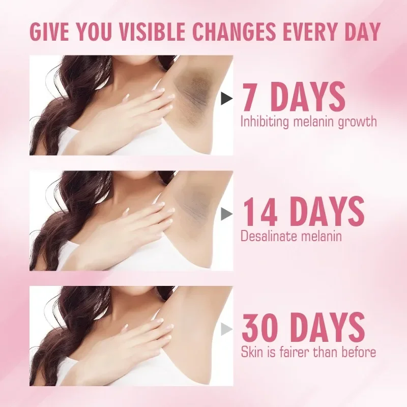 Intimate Firming cream Underarm Bleaching Whitening Private Parts Butt Knee Brighten Whiten Inner Thigh Dark Remove Melanin