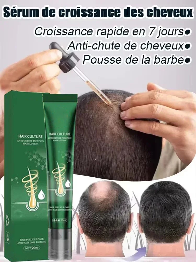 

Ginger Hair Care Oil for Men and Women to Prevent Postpartum Hair Loss and Scalp Care Essence Products