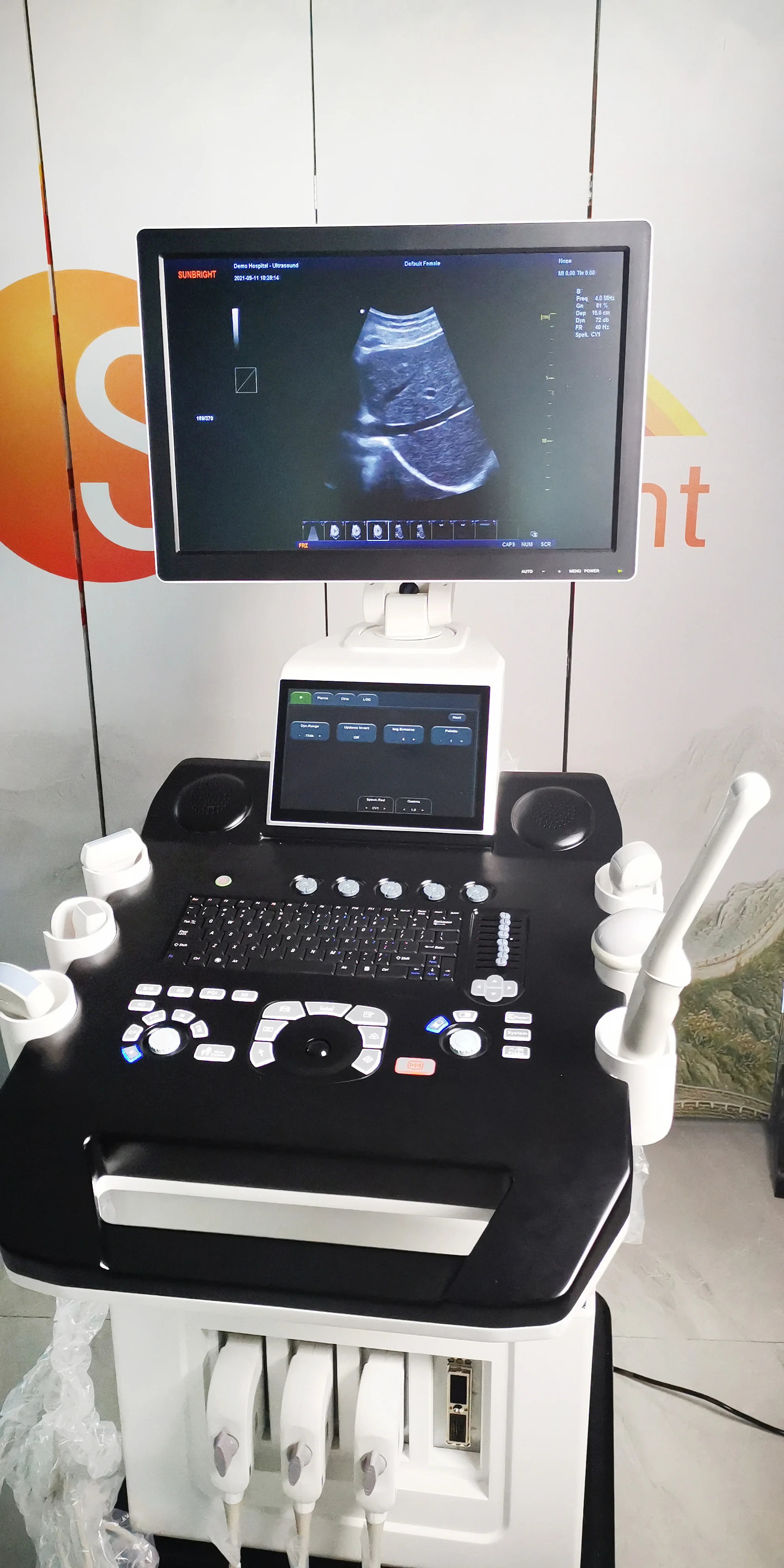 Wholesale price pregnancy ultrasound machine color Doppler ultrasound device SUN-908A trolley