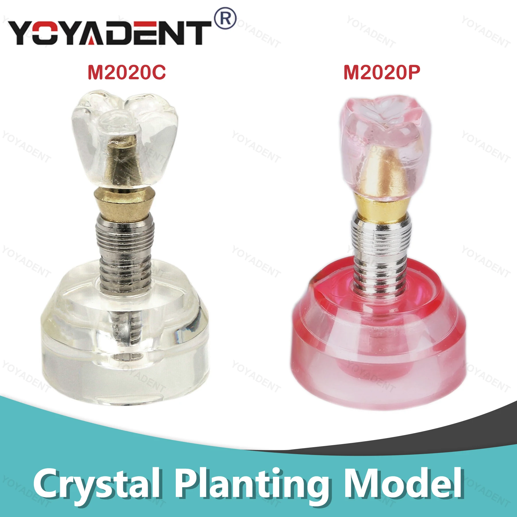 Dental Teeth Model 2.5x size Resins Model Detachable For Teaching And Dentist Patient Communication Demo Dental Accessories
