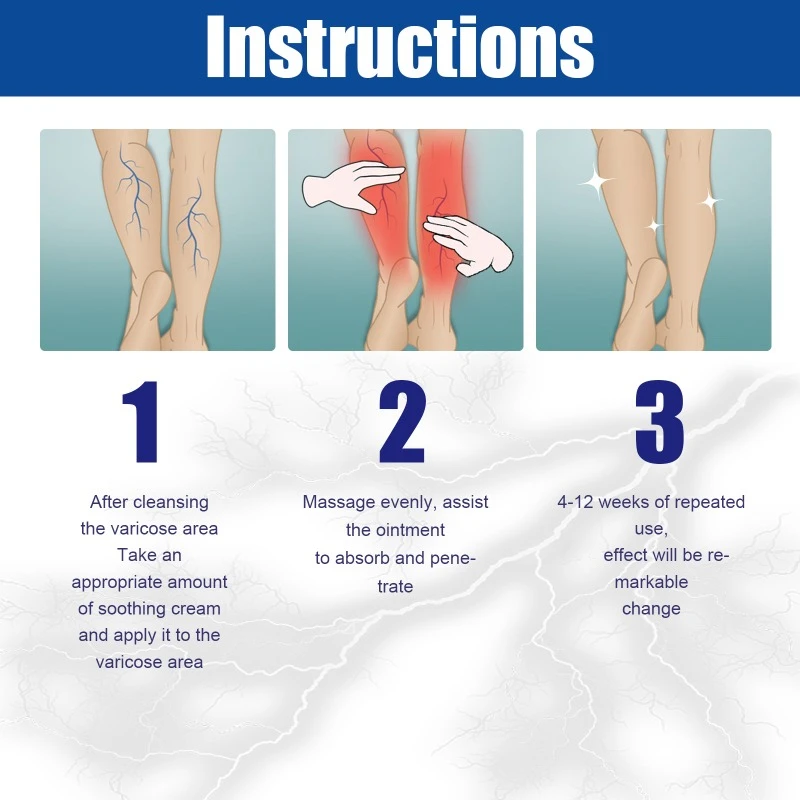 Varicose Vein Repair Cream Tongmai Effective Relieves Leg Bulge Pain Treatment Cream Vasculitis Phlebitis Remove Vein 20g