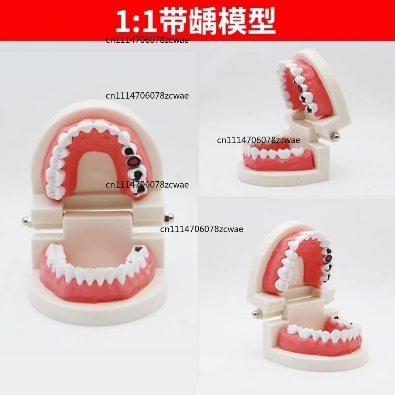 ZOCI-FOR Kindergarten Oral Education Dental Model Simulation Decayed Teeth Mold Kids Tooth Brushing Teaching Toy