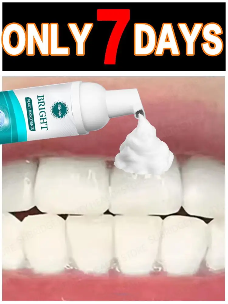 2025 reparação remendo correção de dente na boca remendo descoloração e danos ferramenta de cuidados intraorais