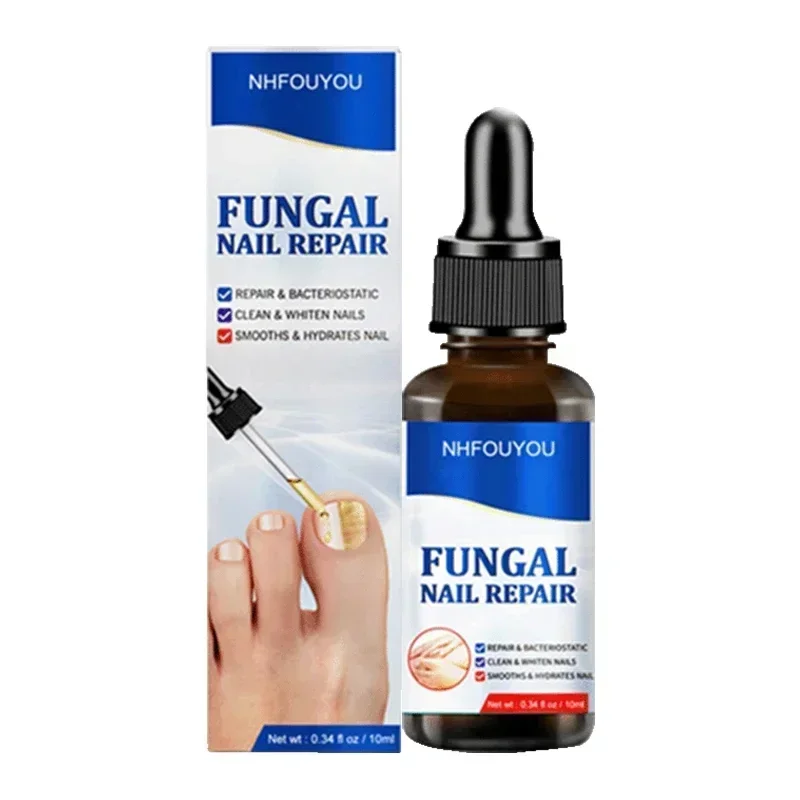 เชื้อราเล็บ Treatment Serum Toe Fungal Repair ผลิตภัณฑ์มือเท้า Care เจลกําจัด Anti Infection Paronychia Onychomycosis