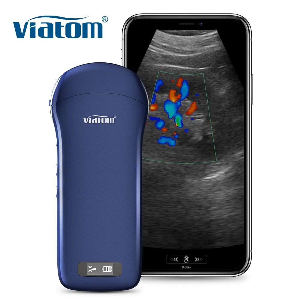 Viatom C10 128 Elements Wireless Scanner Ultrasound Multi-language Support 3 In 1 Medical Portable Handheld Ultrasound Doppler