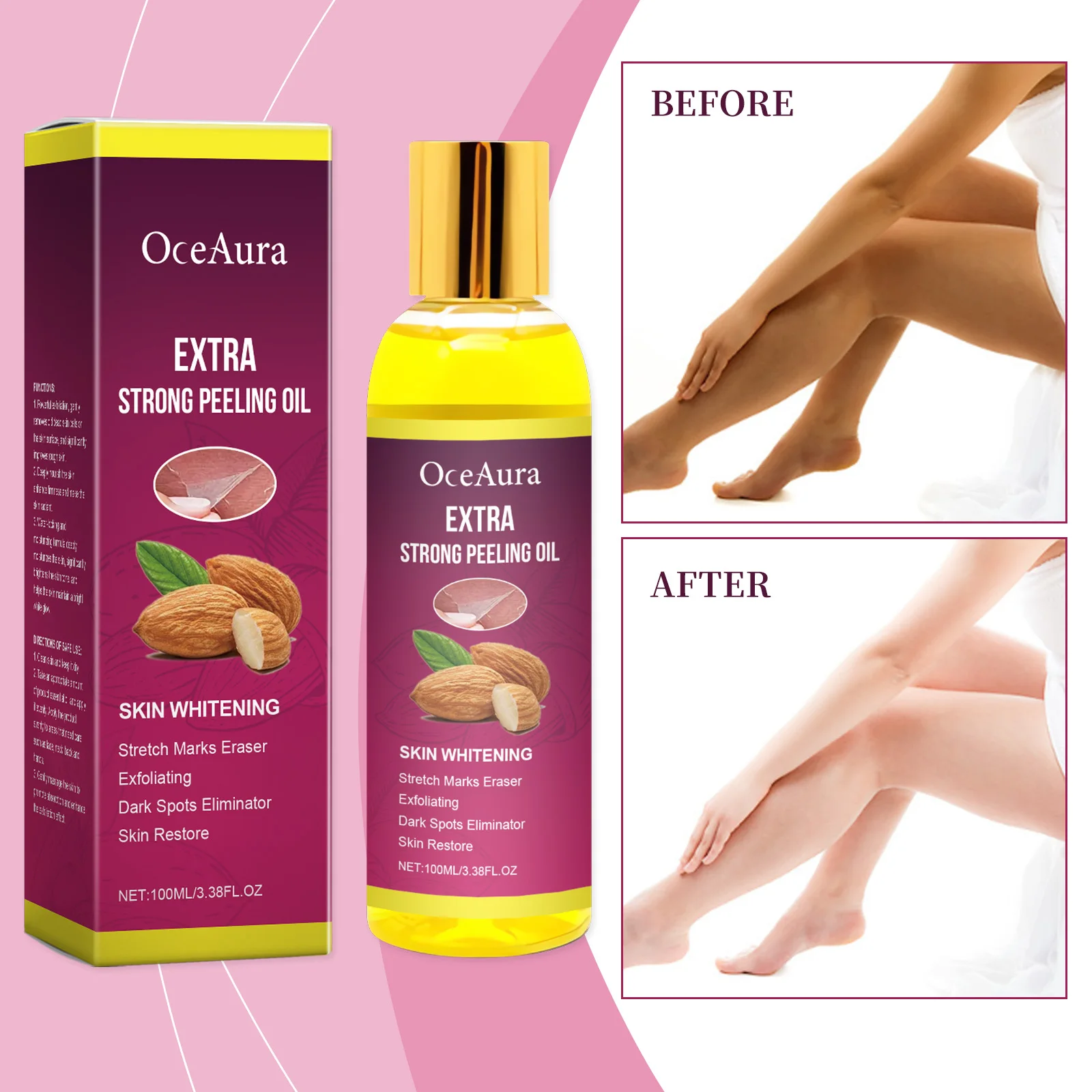 엑스트라 스트롱 필링 오일 - 스트레치 마크, 다크 스팟을 위한 피부 미백 및 각질 제거 트리트먼트 - 100ml/3.38FL.OZ 딥 리스토어링