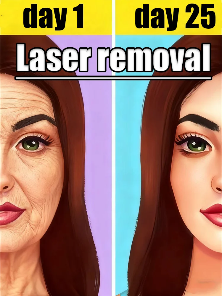 

Moisturizing laser pointer aid, the top choice for young women.