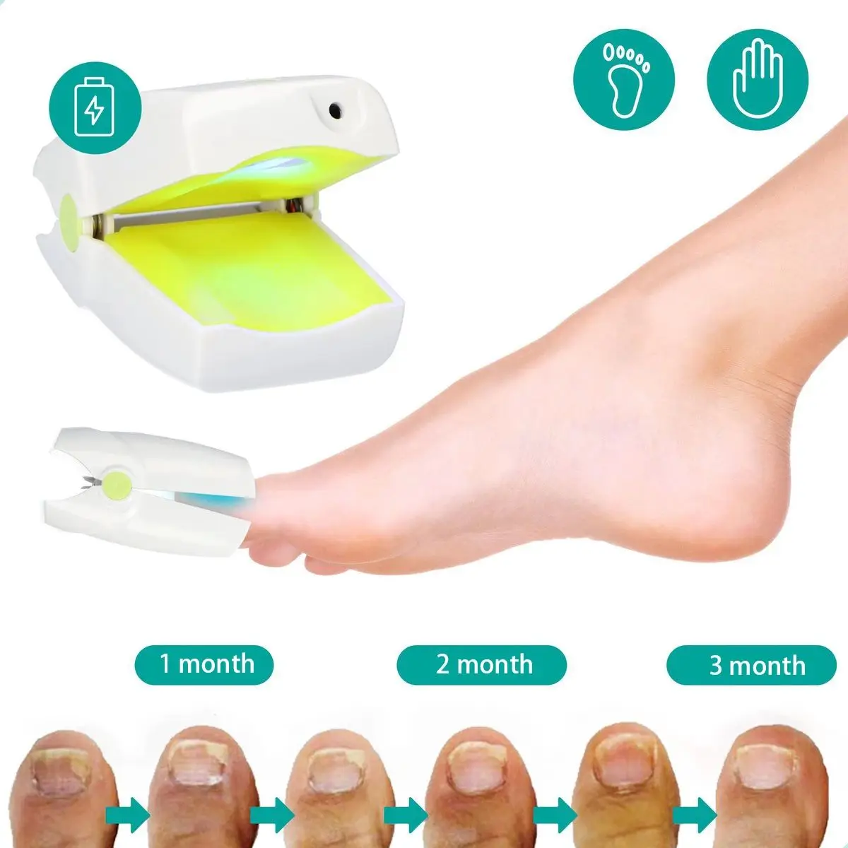 Nail Fungus Laser Device Light Therapy Onychomycosis Toes Treatment 905nm Home Use