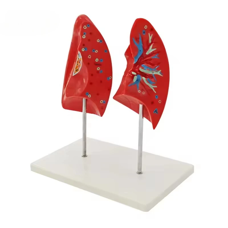 

Medical Science Teaching Resources Teaching Assisted Lung Model High Quality Anatomy Human Anatomy Medical Lung Model