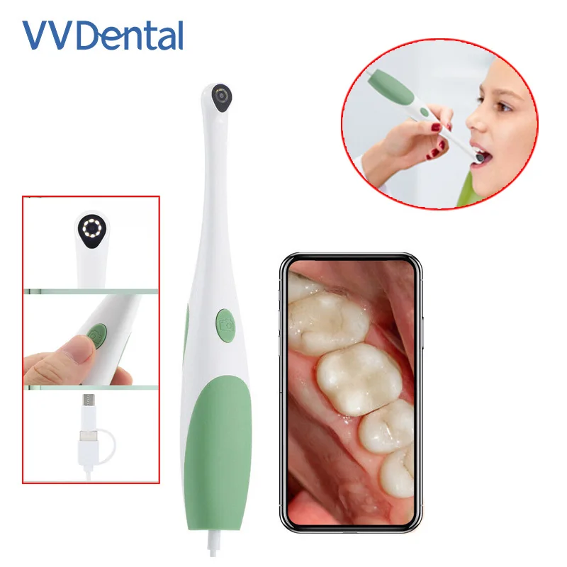 

Dental Oral Camera 480P/1080P HD Electronic Intraoral Examination Camera Mini 3 IN 1 Type-c USB Teeth Detecting Endoscope Camera