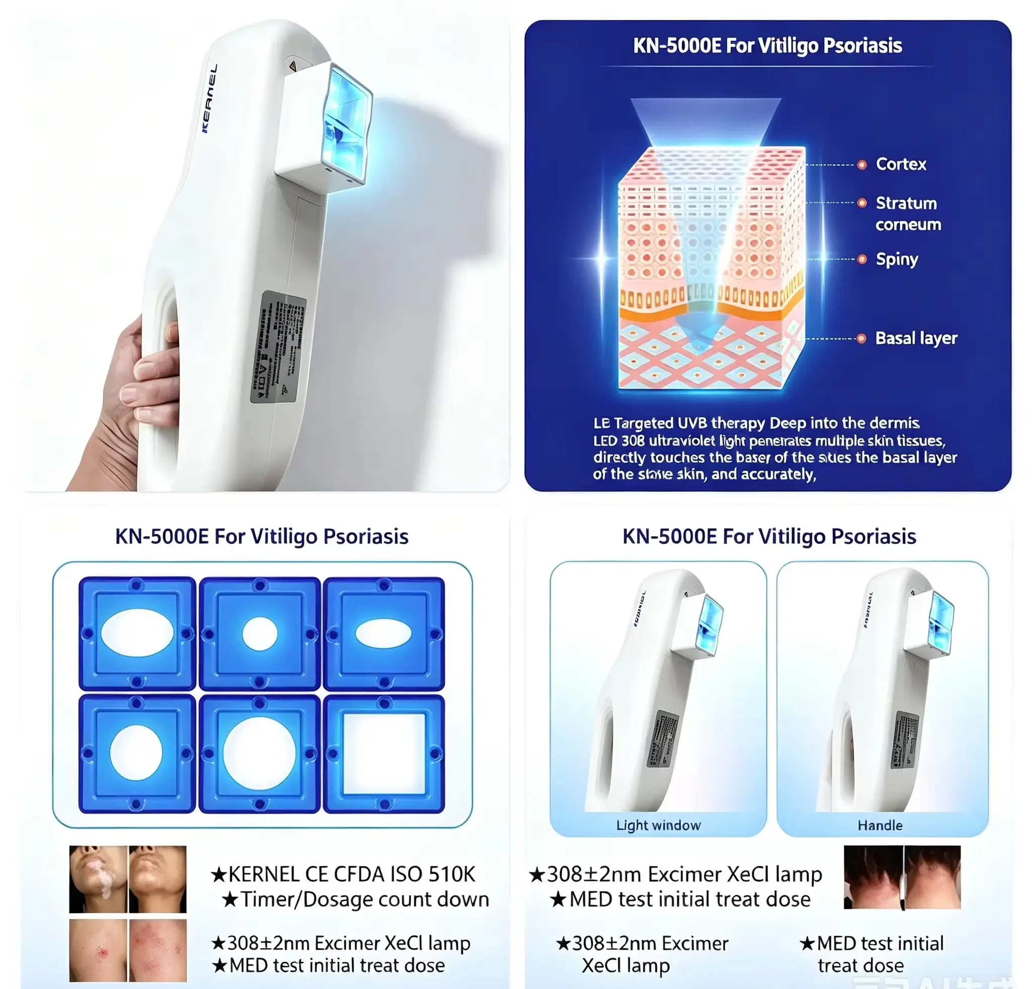 2026 Factory-Direct KN-5000E Excimer Device 308nm Monochromatic Light for Safe And Efficient Results - Hot Selling