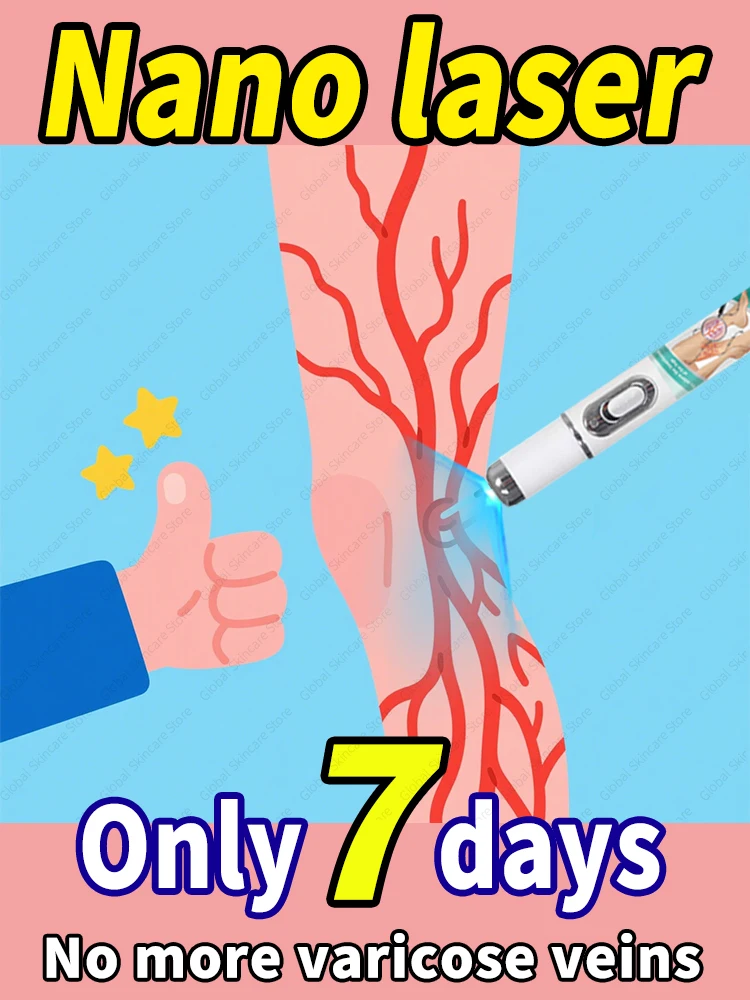 

New nano-laser device for treating varicose veins High quality varicose vein device