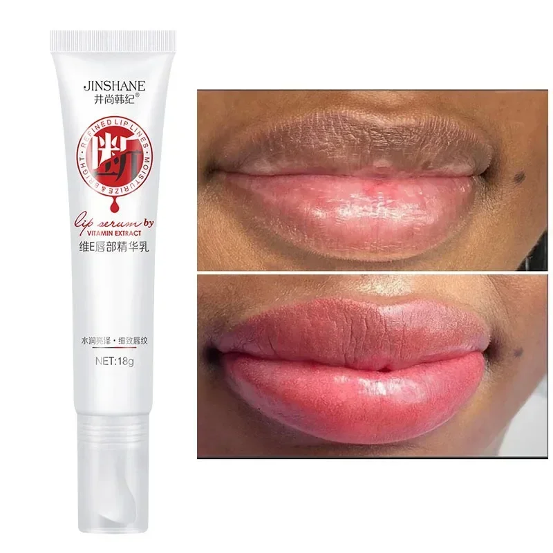 Pink Mouth Lips Serum Fast Lightening Bleaching Permanent Pinkish Moisturizing Lighten Dark Lip Balm Gloss Lipstick Lip Mask