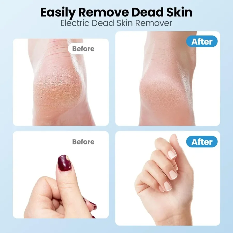 Elektryczny pilnik do stóp 2 w 1, elektryczna szlifierka do stóp, akumulatorowy, bezprzewodowy skrobak do stóp do martwego naskórka, regulowany.
