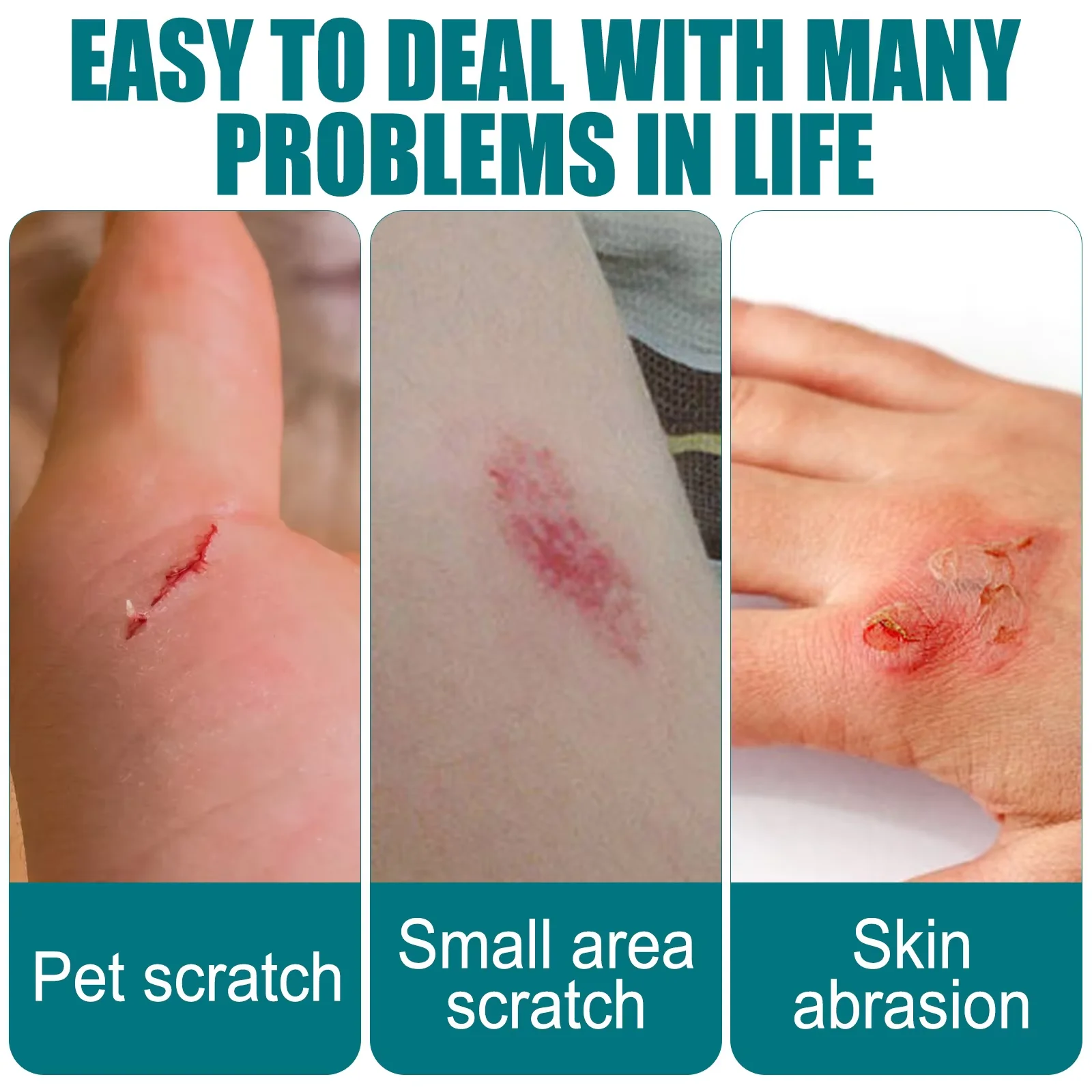 

South Moon Liquid Band-Aid Waterproof Invisible Bandage Wound Fast Healing Dressing Gel Medical Hemostatic Patch Liquid 10ml