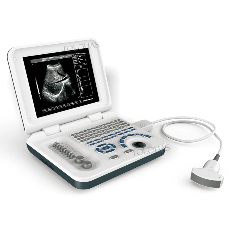 

LHAS30 Medical clinic BW ultrasound scanner full digital portable small laptop ultrasound with low price