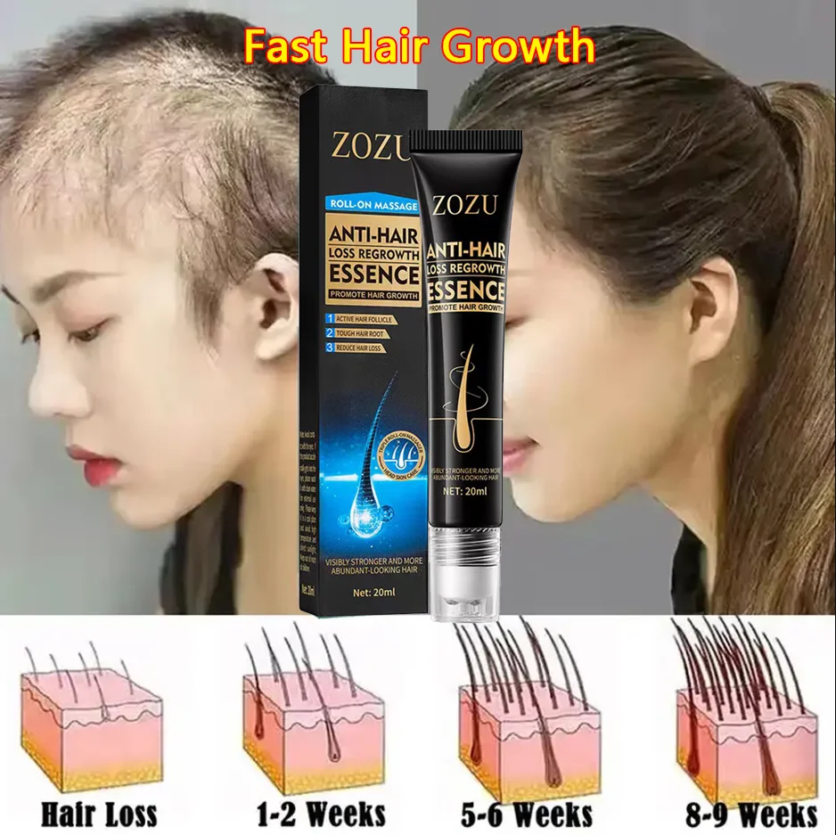 

2023 Biotin Fast Hair Growth Oil Hair Regrowth Serum Hair Thinning Treatment Hair Growth Liquid Anti-Hair Loss for Women amp Men