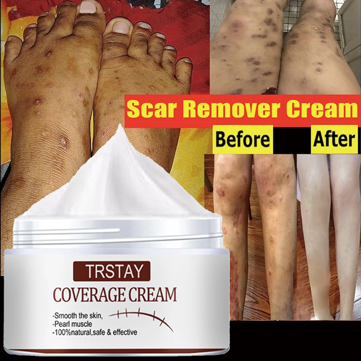 

TRSTAY Натуральный консилер для кожи Разглаживает шрамы Отбеливает крем для лица для безопасного и эффективного ухода за кожей