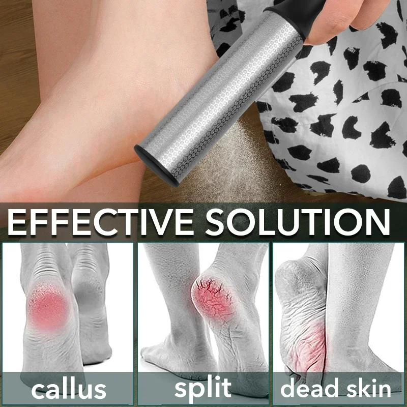 1 Stuks Eelt Remover Voor Voeten Professionele Pedicure Kit Voet Scrubber Voor Droge Dode Gebarsten Harde Huid Pedicure Bestand Care tool