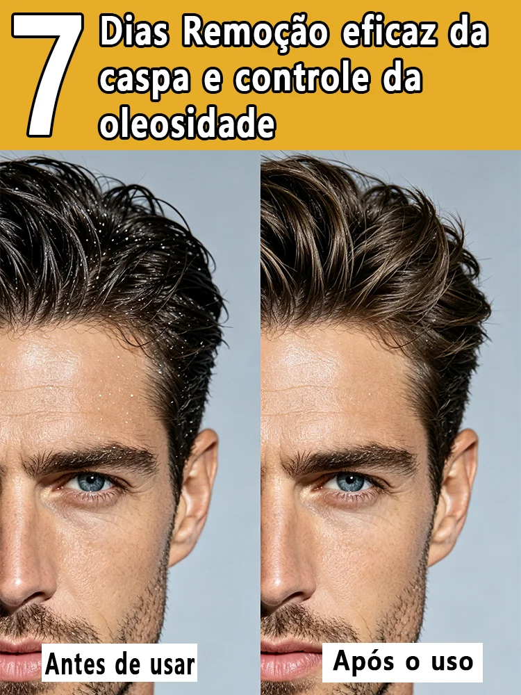 anti-dandruff-shampoo-deep-scalp-cleansing-oil-control-refreshing-fluffy-hair-for-all-hair-types
