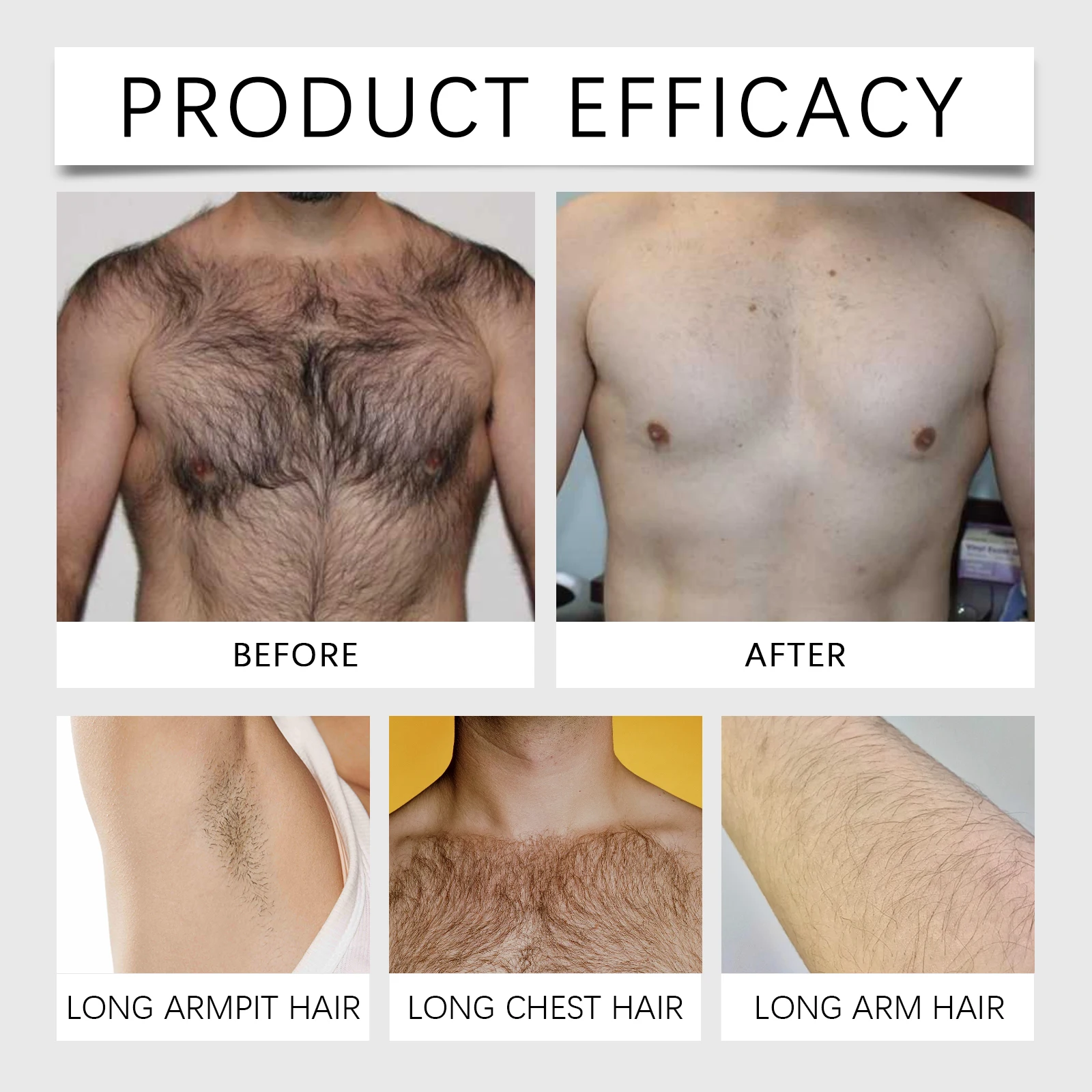 Men's Hair Removal Cream Nourishing Painless Non-Irritating Inhibits Growth Body Hair Removal And Can Be Used On Private Areas