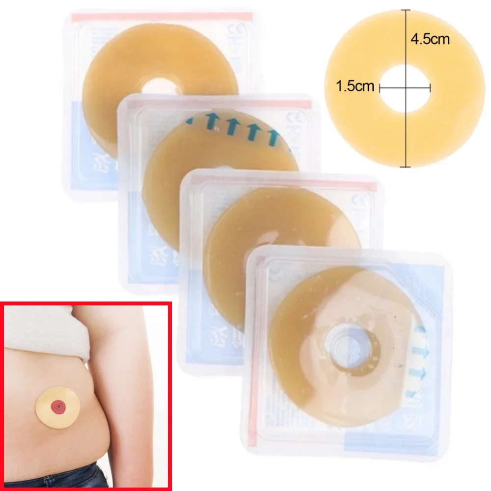 2/4mm Colostomy Bag Anti-leak Ring Paste Stoma Bags Supplies Protective Barrier Rings Ostomy Bag Leak Proof Sealing Sticker