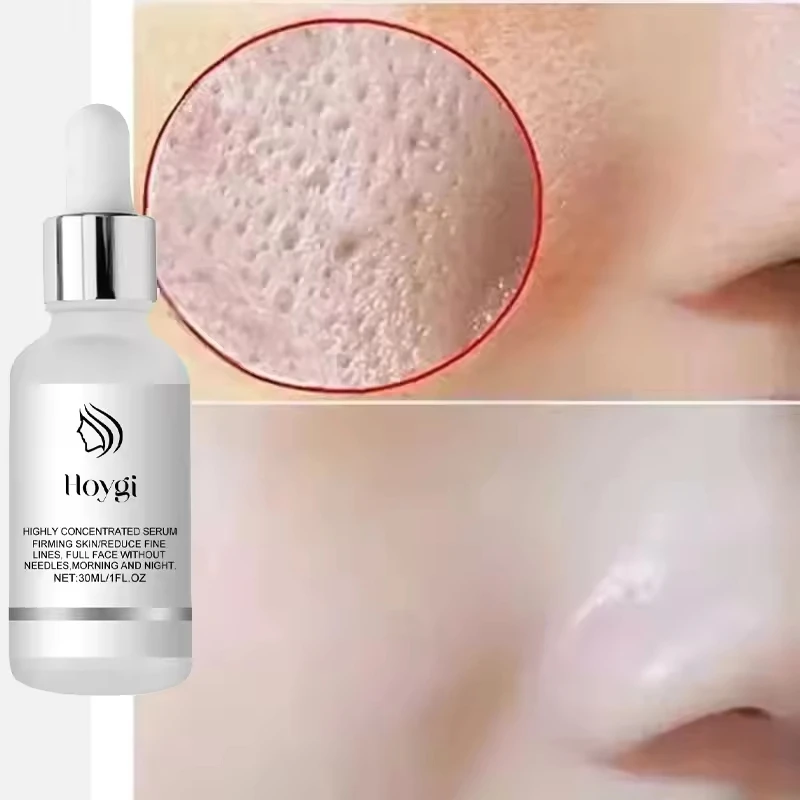 

Remove Large Pores Serum Lactic Acid Facial Pores Shrinking Repairing Products Pores Minimizing Firming Smooth Korean Skin Care