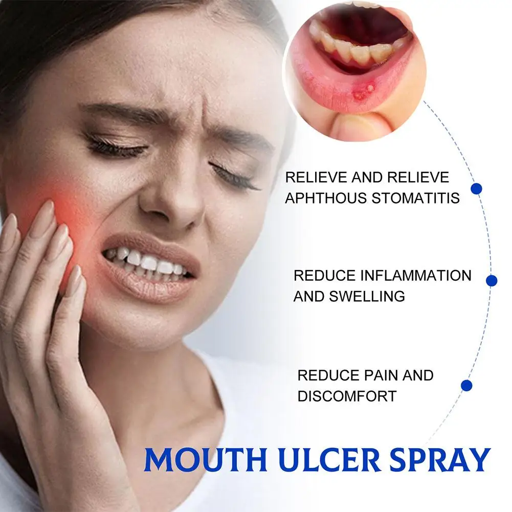 30ml Mouth Ulcer Spray Treatment Swollen Gums Oral Canker Sores Pain Relief Fresh Breath Antibacteria Halitosis Mouth Clean Care