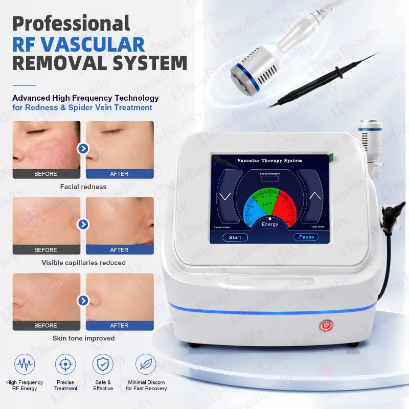 13.56MHz High‑Frequency RF Vascular Removal Machine Spider Vein Facial Redness Eliminator Salon Skin‑Care Beauty Treatment Equip