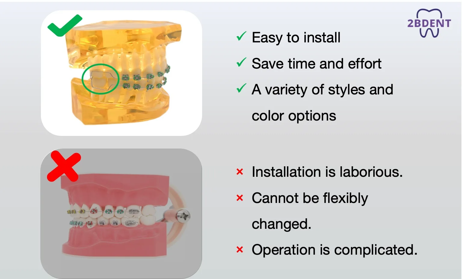 Modische Zahnspangen, bunt, 1 Paar, temporäre Zahndekoration mit Metalldrähten, Metallhalterung, kieferorthopädische Ligaturen, hohe Qualität – Detail 9