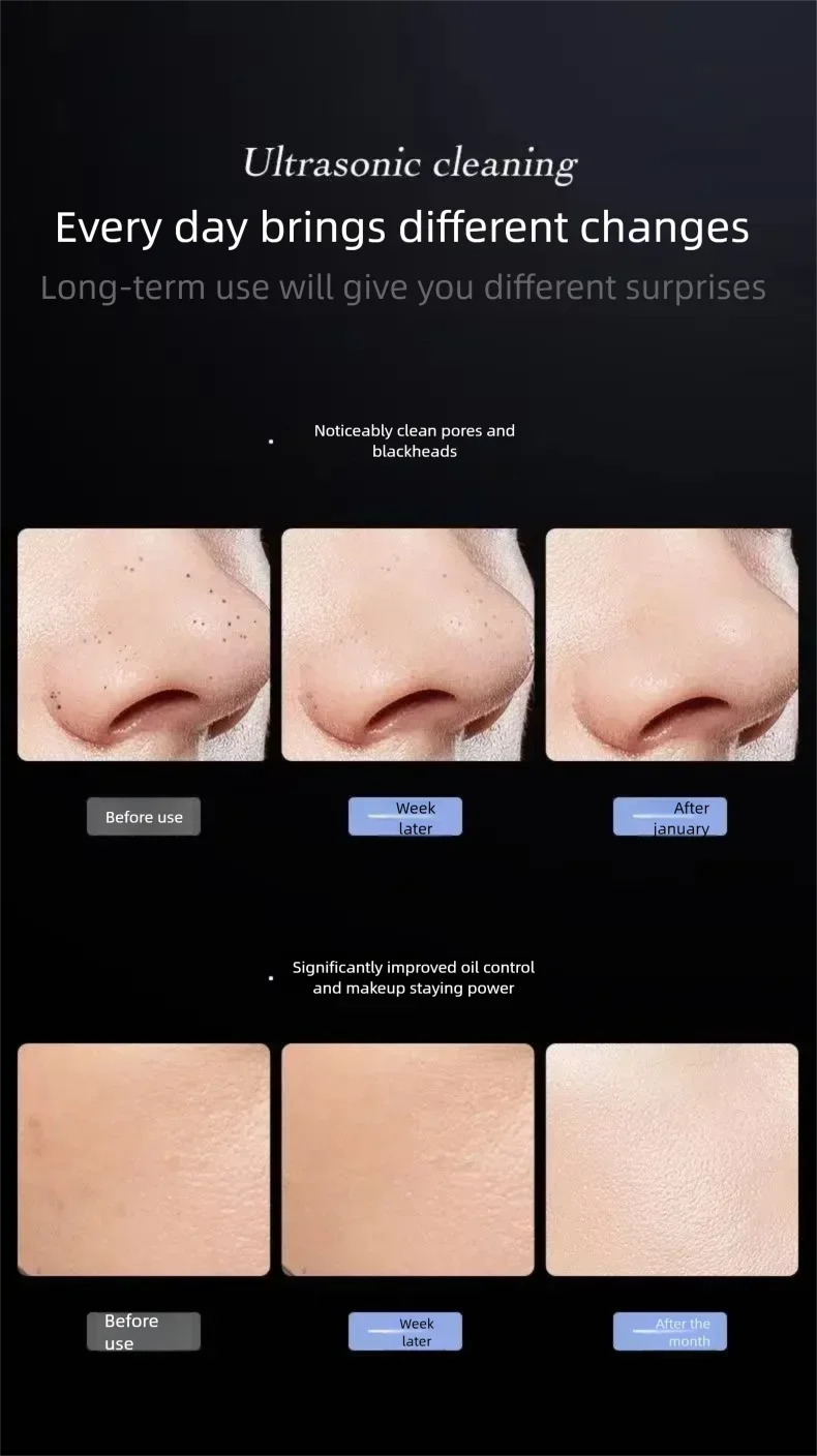 Raschietto per la pelle ad ultrasuoni Dispositivo di bellezza a vibrazione Raschietto per punti neri Pulizia del viso Rimozione dell'acne Pulizia dei pori Lifting Rassodante