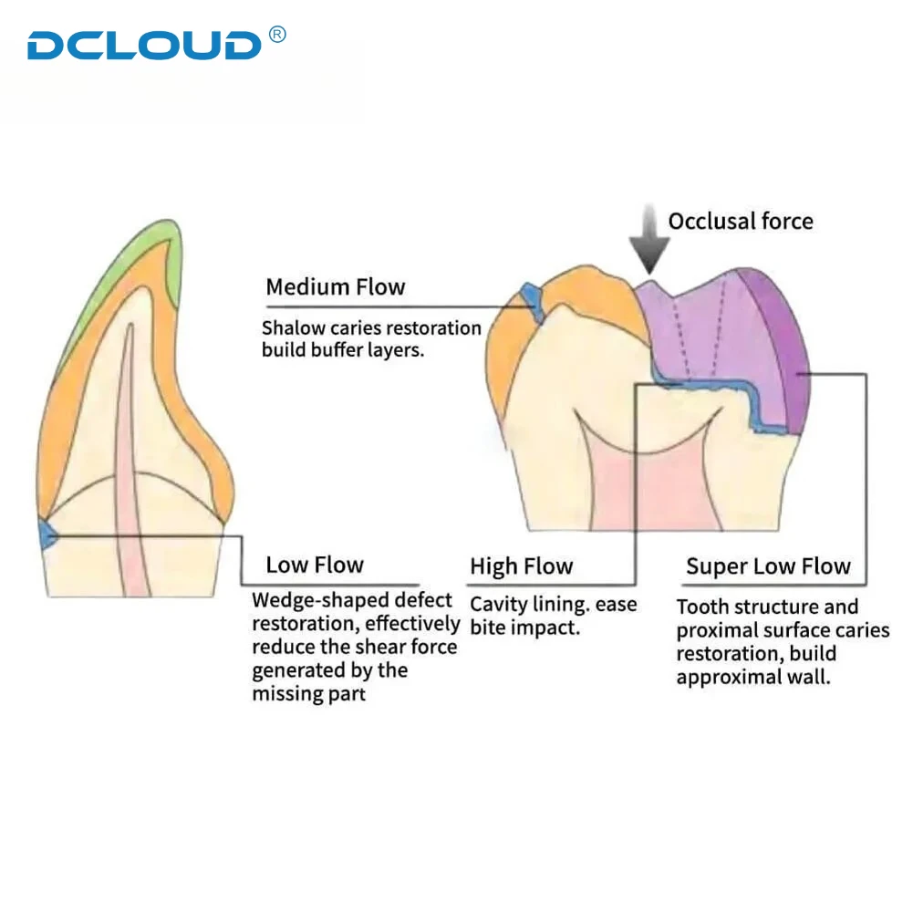 Dentex 3g/Pc Flow Light Curing Dental Composite Resins Teeth Filling Material Micro Hybrid Flowable Resin for Crown Restoration
