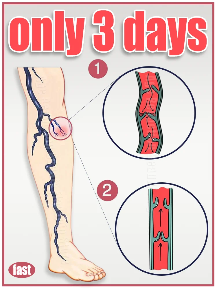 

Hot-selling products in 2025: Massage tools, leg soreness relief products