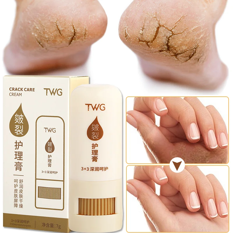 

Moisturizing Anti Crack Care Cream For Rough Dry Chapped Hand Feet Heel Removal Dead Skin Exfoliating Nourishing Skin Care Balm