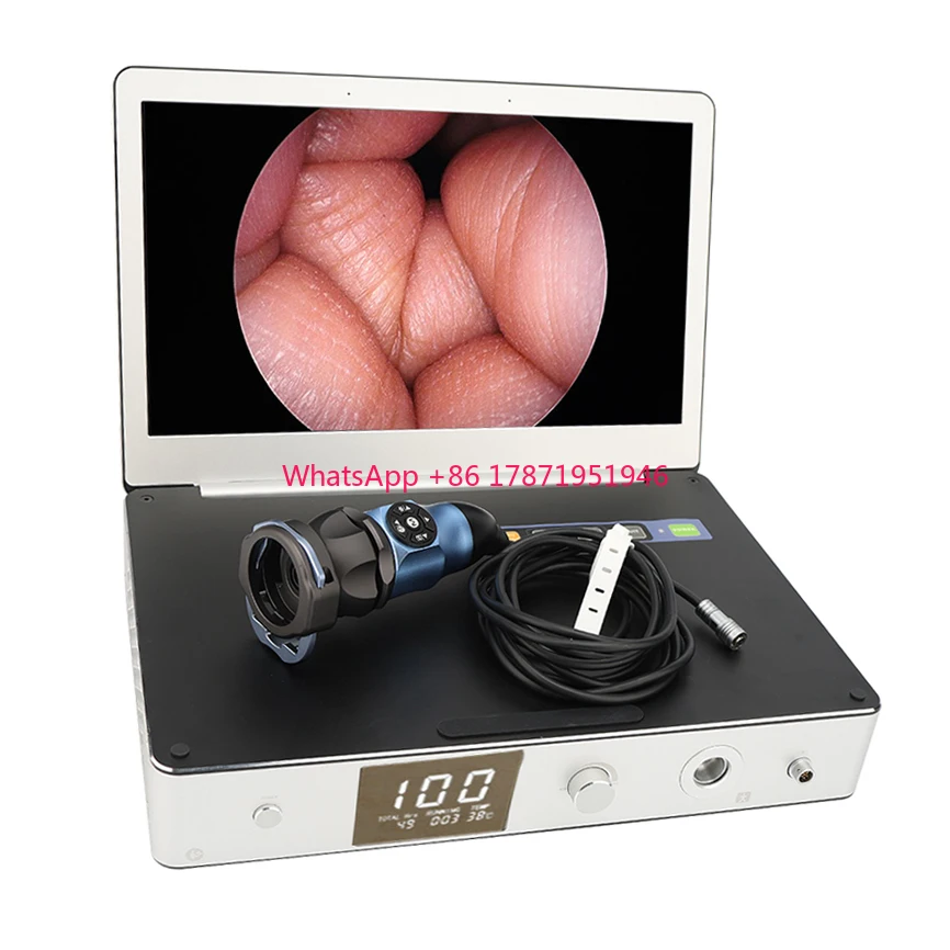 Factory delivery endoscope camera system all in one,11.6 Inch USB HDMI full HD Endoscope Camera System ENT