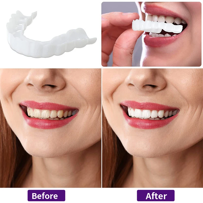 Perfect Fit Teeth Whitening Fake Tooth Cover Snap On Silicone Smile Veneers Teeth Upper Beauty Tool Cosmetic Teeth High-Quality