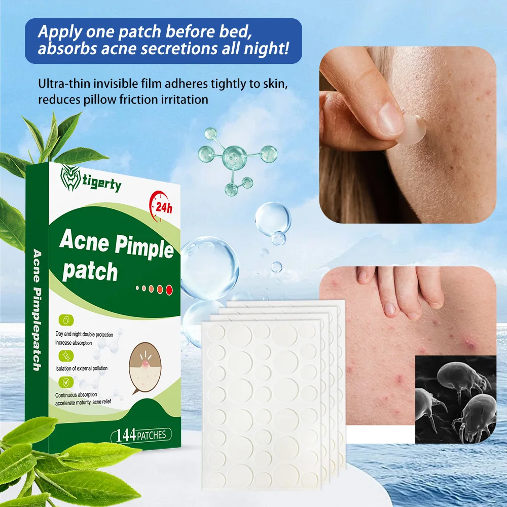 Tigerty Acne Pimple Patch with Increased Absorption Isolation of External Pollution for Accelerated Maturation Acne Relief And S