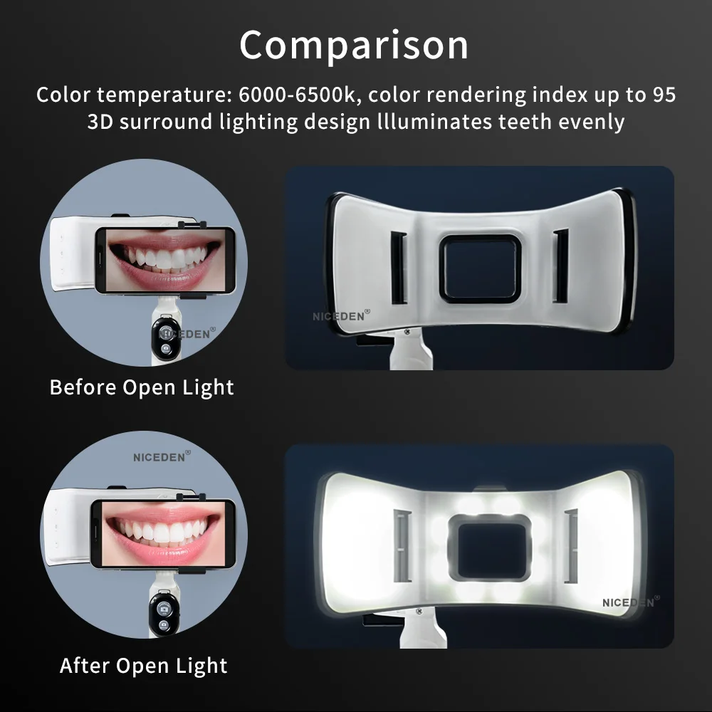 Thumbnail 3 - #14 Best Rated Oral Lamps to Buy in 2026