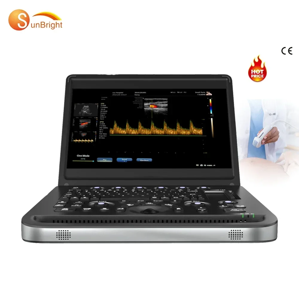 SUN-906B High Quality Portable Ultrasound Machine Portable 3D Color Doppler Machine Medical Equipment